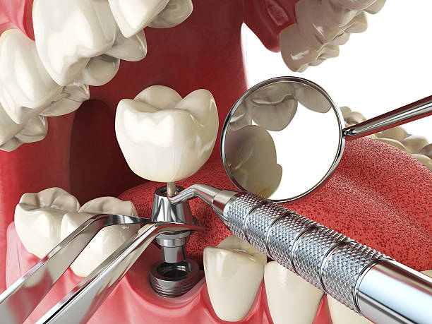 Best Orthodontic Emergency Dentist in Ocean City, MD